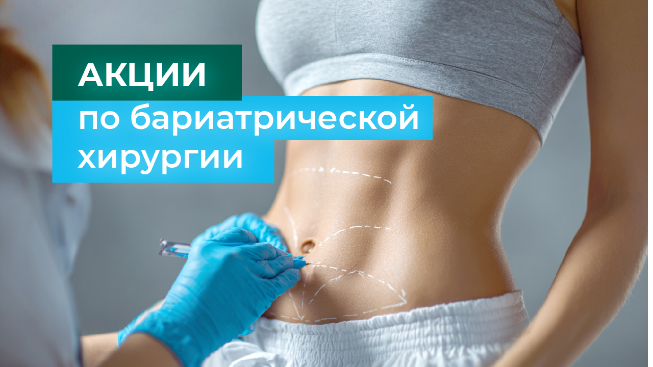 Бариатрическая операция  + устранение ГПОД В ПОДАРОК!