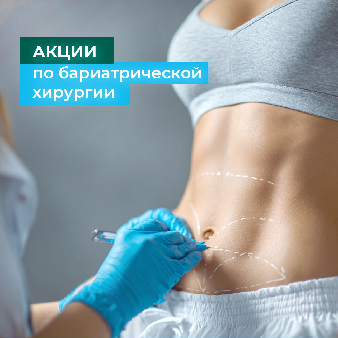 Бариатрическая операция + устранение ГПОД В ПОДАРОК!