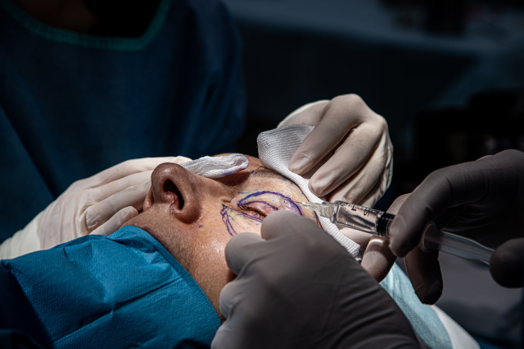 блефаропластика