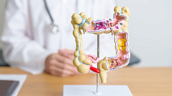 Гастрочекап: модно и очень важно