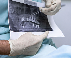 Механизм боли. Сигналы для внимательных (к себе) пациентов